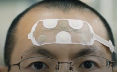 Electroencephalography (EEG)
